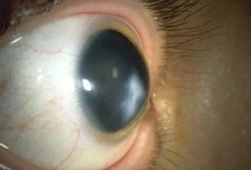 Doctor Reacts To Jake Paul’s Knockout Of Ben Askren And CTE Claim