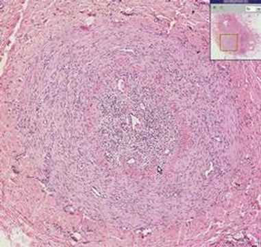 Star Indonesia Hotel