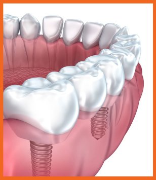 ) Healthy Completely happy Information